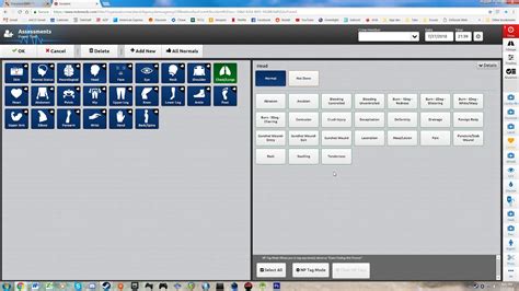 Emeds elite - The OEMS Patient Care Information System is comprised of the Virginia Statewide Trauma Registry (VSTR) and the Prehospital Patient Care Reporting System (VPHIB and Elite). All licensed EMS agencies and hospitals in Virginia are mandated by the Code of Virginia to report the minimum required data set (§32.1-116.1). The VSTR and …